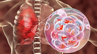 Masyarakat Jangan Panik Sikapi Pneumonia di Tiongkok