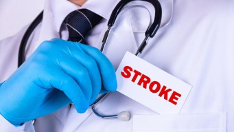 Tips Mengenali Gejala Stroke dan Cara Pencegahannya