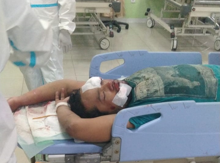 Jambret saat Transisi New Normal, Bandit Jalanan Nyaris Tewas Dimassa
